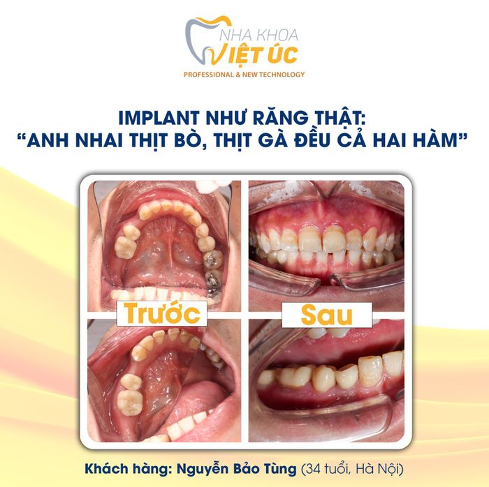 Hình ảnh Nha khoa Việt Úc 2