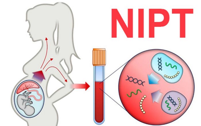 Hình ảnh 2 của Xét nghiệm NIPT ihope