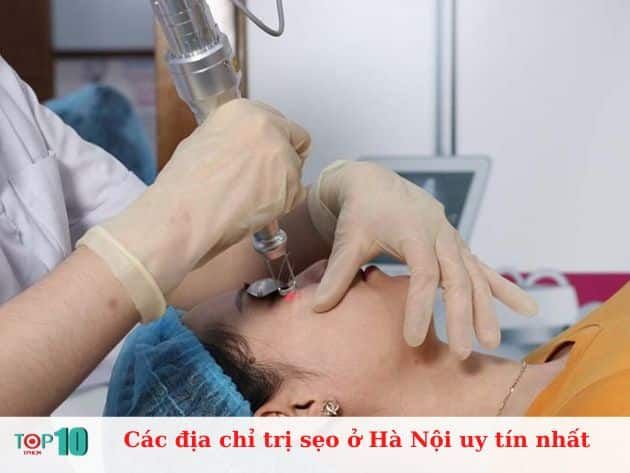 Danh sách các địa chỉ uy tín điều trị sẹo tại Hà Nội