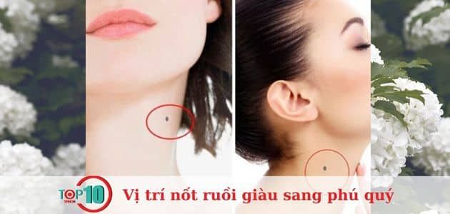 Nốt ruồi trên cổ