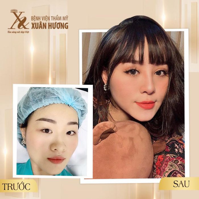 Hình ảnh 2 của Trung Tâm Thẩm Mỹ Xuân Hương