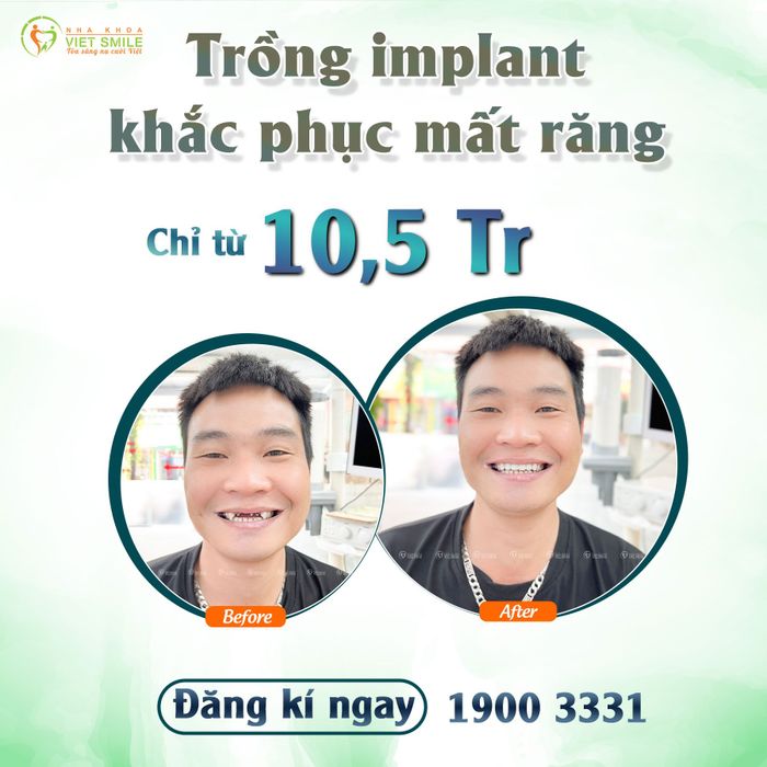 Nha khoa VIET SMILE - Hình ảnh 2