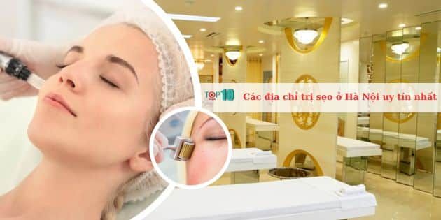 Những địa chỉ điều trị sẹo uy tín tại Hà Nội