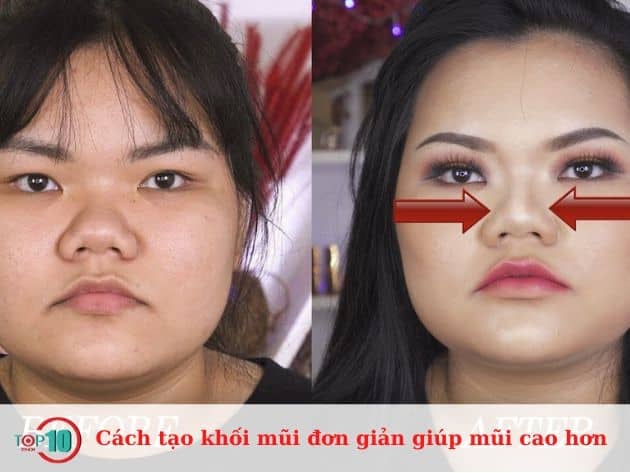 Cách tạo khối mũi để nâng cao mũi hiệu quả