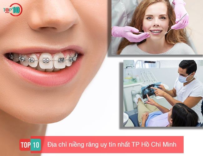 Danh sách 10 địa chỉ niềng răng uy tín nhất tại TP. Hồ Chí Minh