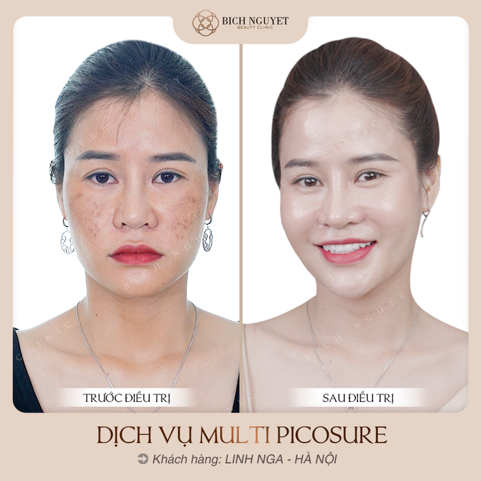 Bích Nguyệt Beauty Clinic hình ảnh 2