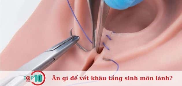 Vết thương tầng sinh môn sẽ tự hình thành da non và khép lại sau 2 đến 4 tuần