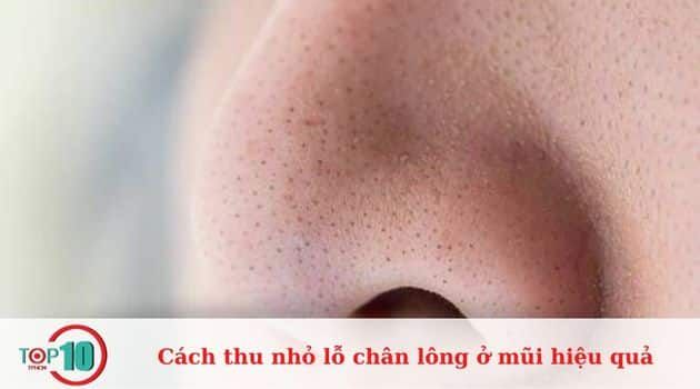 Những dấu hiệu cho thấy lỗ chân lông ở mũi đã to