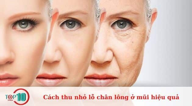 Lão hóa là một trong những nguyên nhân chính dẫn đến lỗ chân lông to