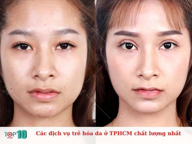 Những dịch vụ trẻ hóa da hàng đầu tại TPHCM