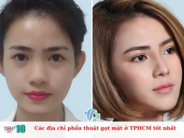 Gọt cằm ở đâu tại TPHCM uy tín?