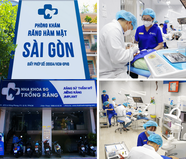 Nha Khoa Trồng Răng Sài Gòn