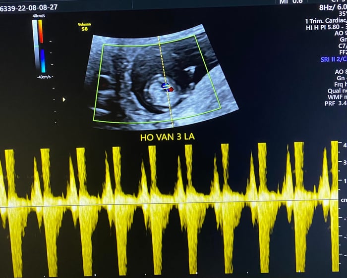 Hình ảnh 2 của Trung tâm Chẩn đoán Trước Sinh Dr Long