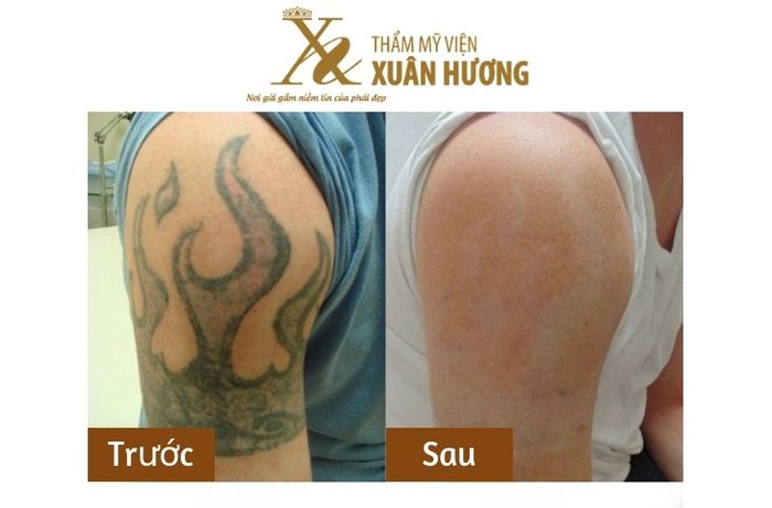 Thẩm mỹ viện Xuân Hương - Hình 2