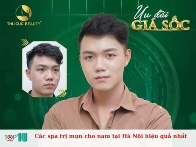 Các spa trị mụn cho nam tại Hà Nội hiệu quả nhất