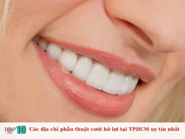 Bạn đang tìm kiếm địa chỉ phẫu thuật cười hở lợi uy tín? <strong>Nha khoa Paris</strong> là một sự lựa chọn đáng tin cậy.