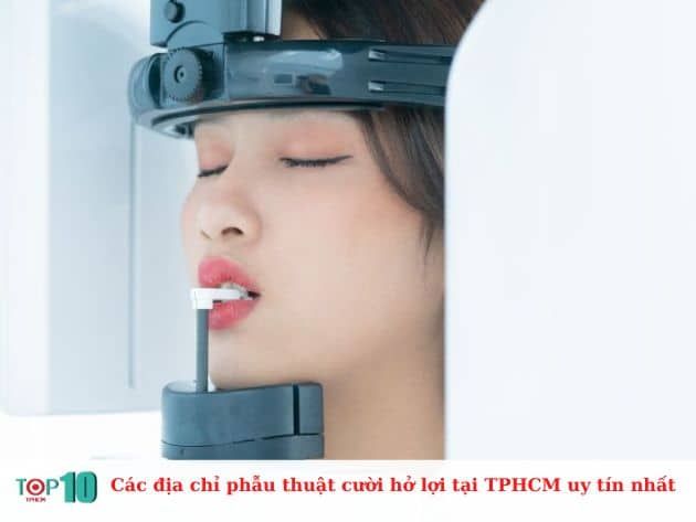 Nơi nào phẫu thuật cười hở lợi tốt nhất