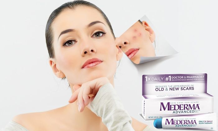 Top 10 sản phẩm thuốc trị sẹo hiệu quả mà bạn nên thử: Mederma