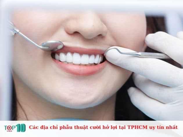 Danh sách các địa chỉ uy tín phẫu thuật cười hở lợi tại TPHCM