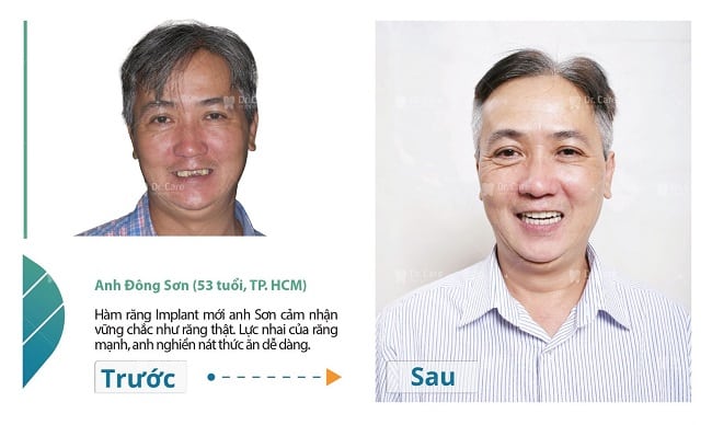 Bệnh viện trồng răng Dr. Care