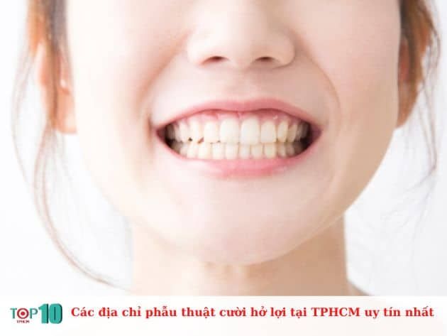 Các địa chỉ uy tín để phẫu thuật cười hở lợi tại TPHCM