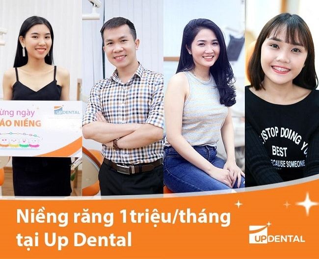 Khách hàng thực hiện niềng răng tại Up Dental