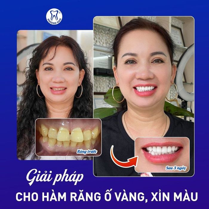 Hình ảnh Nha Khoa Phương Nam 1