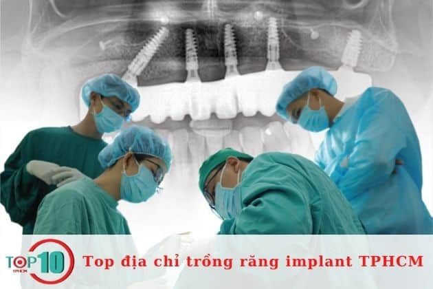 Cơ sở cấy ghép răng implant uy tín tại TPHCM | Nguồn: Dr. Care Implant