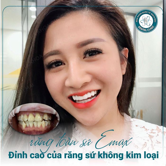 Nha Khoa Quốc Tế Bạch Mai hình 1