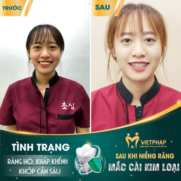 Hình ảnh Nha Khoa Quốc Tế Việt Pháp số 1