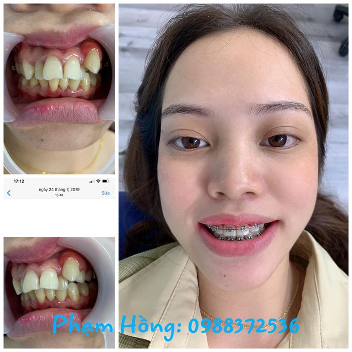 Nha Khoa Quốc Tế Shine Smile - Hình ảnh 2