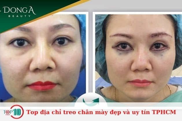 Bệnh Viện thẩm mỹ Đông Á