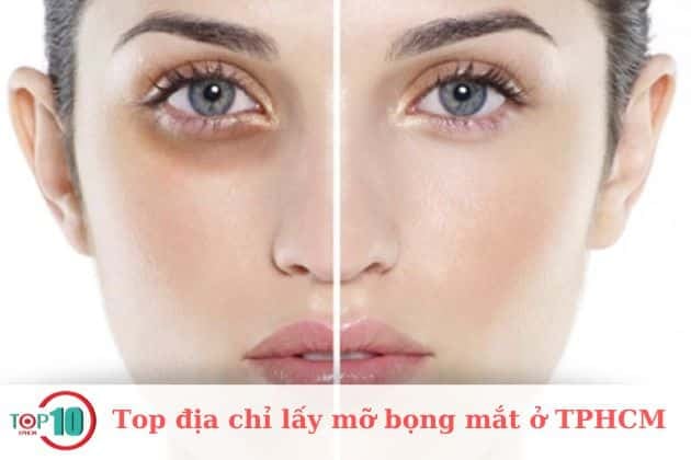 Thẩm mỹ viện Hùng Vương