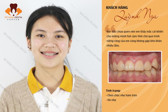 Hình ảnh 1 của Nha Khoa Trâu Quỳ - Dr Hưng Dental Center