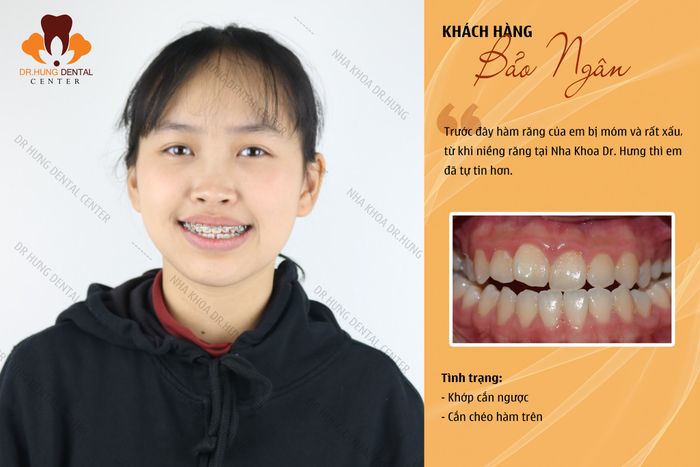 Ảnh 2 của Nha Khoa Trâu Quỳ - Dr Hưng Dental Center