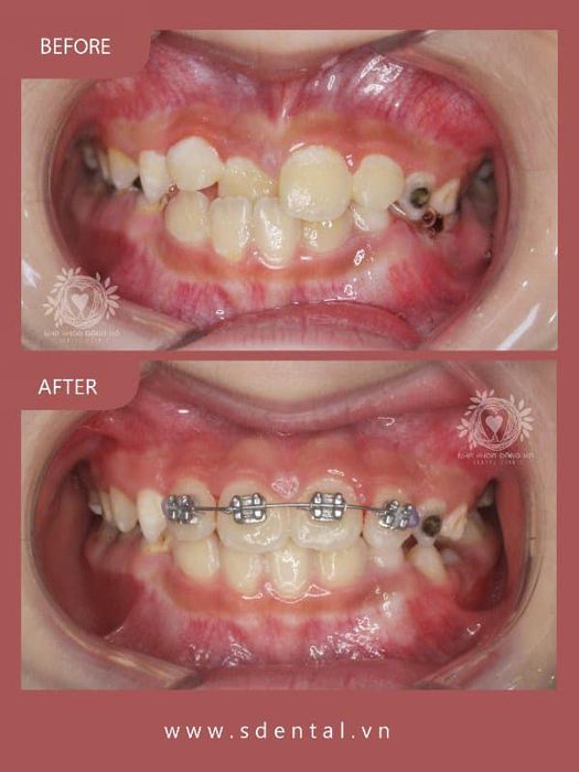 Hình ảnh 2 của S-Dental Nha Khoa Đặng Xá