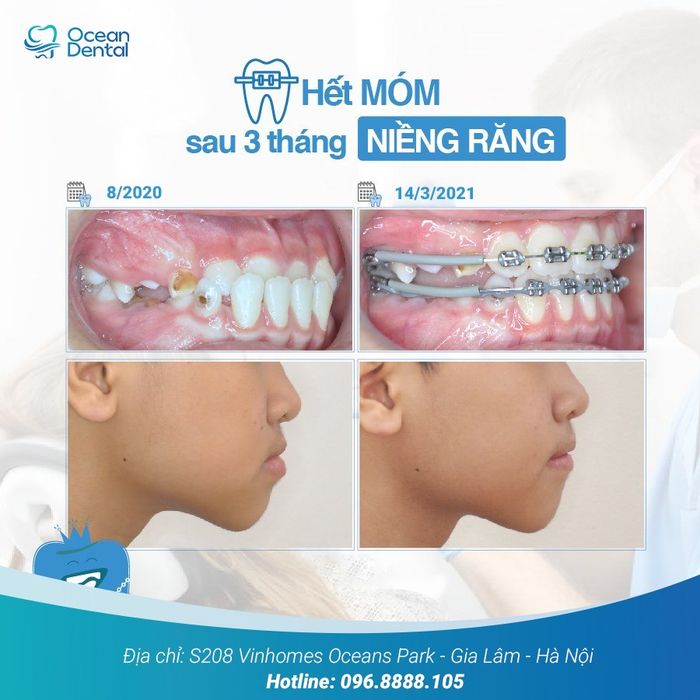 Ảnh 2 của Nha Khoa Thẩm Mỹ Dr.Cường