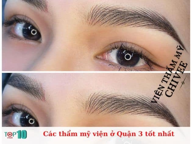 Các thẩm mỹ viện ở Quận 3 tốt nhất