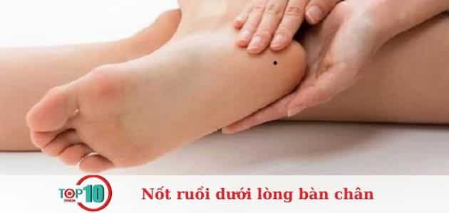 Nốt ruồi ở lòng bàn chân có ý nghĩa gì?