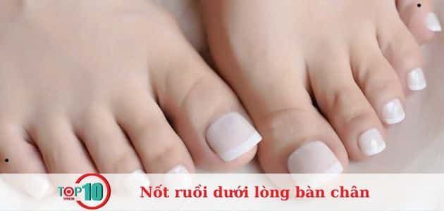 Nốt ruồi ở ngón chân út