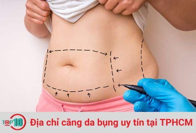 Viện thẩm mỹ Diamond áp dụng kỹ thuật căng da bằng chỉ để giúp vòng 2 trở nên thon gọn và săn chắc hơn