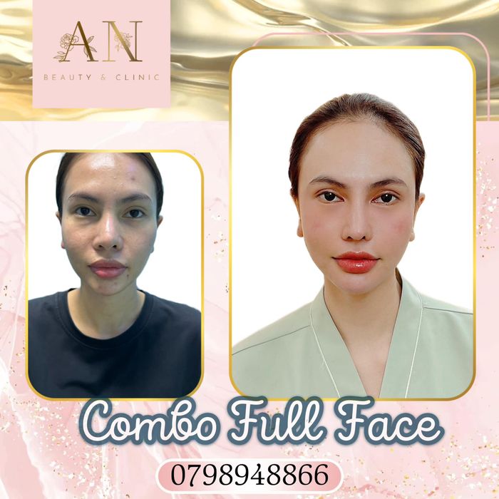 An Beauty Clinic - Ảnh 2