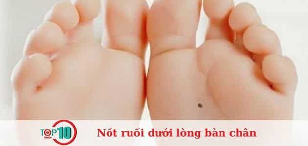 Ý nghĩa của nốt ruồi dưới lòng bàn chân