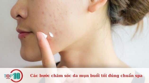 Thoa kem trị mụn an toàn