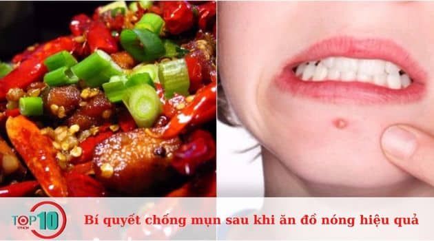 Cách phòng tránh mụn sau khi ăn thực phẩm nóng một cách hiệu quả