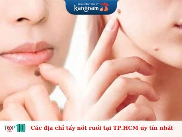 Những địa chỉ tẩy nốt ruồi uy tín nhất tại TP.HCM