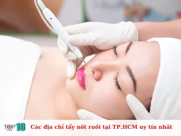 Các địa chỉ tẩy nốt ruồi tại TP.HCM uy tín nhất