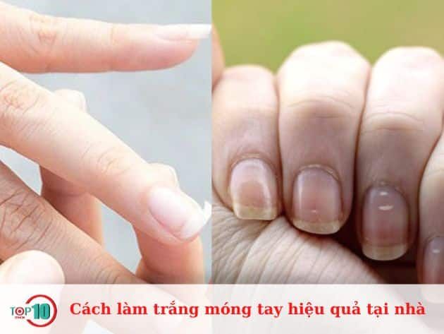 Cách làm trắng móng tay hiệu quả tại nhà