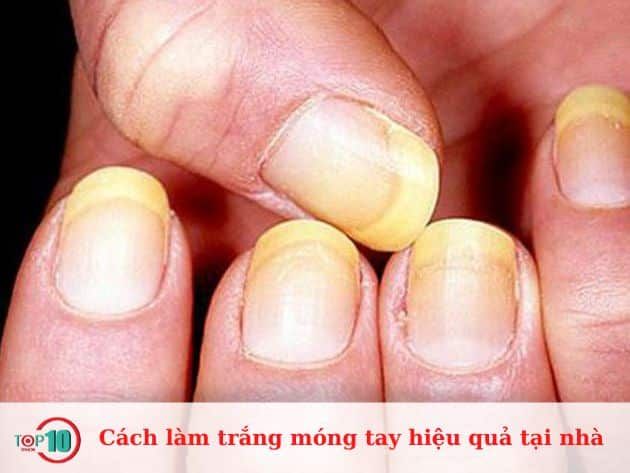 Cách làm trắng móng tay hiệu quả ngay tại nhà