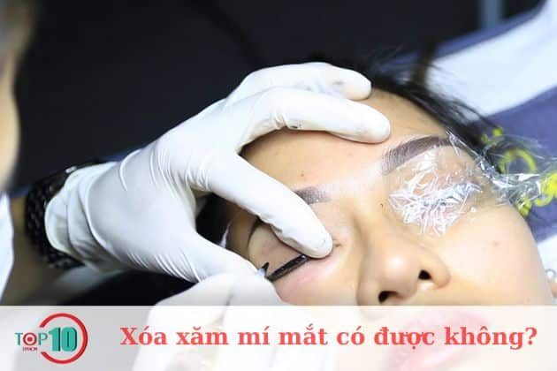 Có cần xóa xăm mí mắt không?